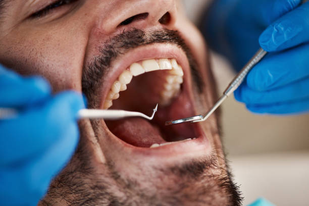 Best Chipped Tooth Repair Near Me  in Waldo, AR